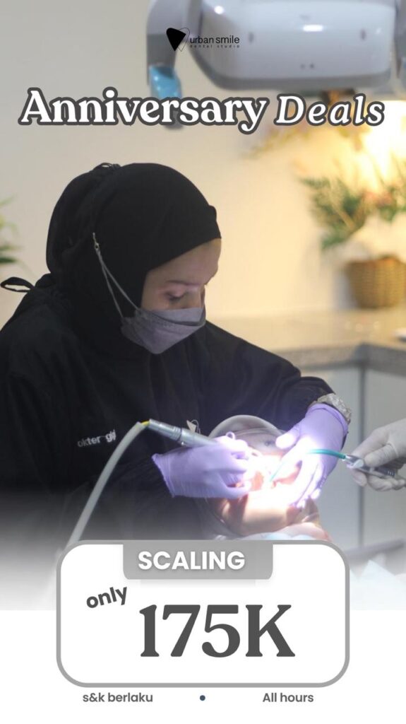 promo scaling only 175k