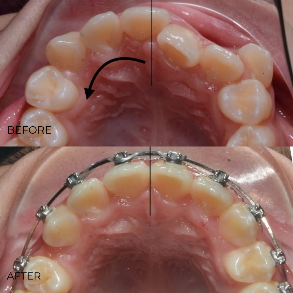 Before after webiste (1)