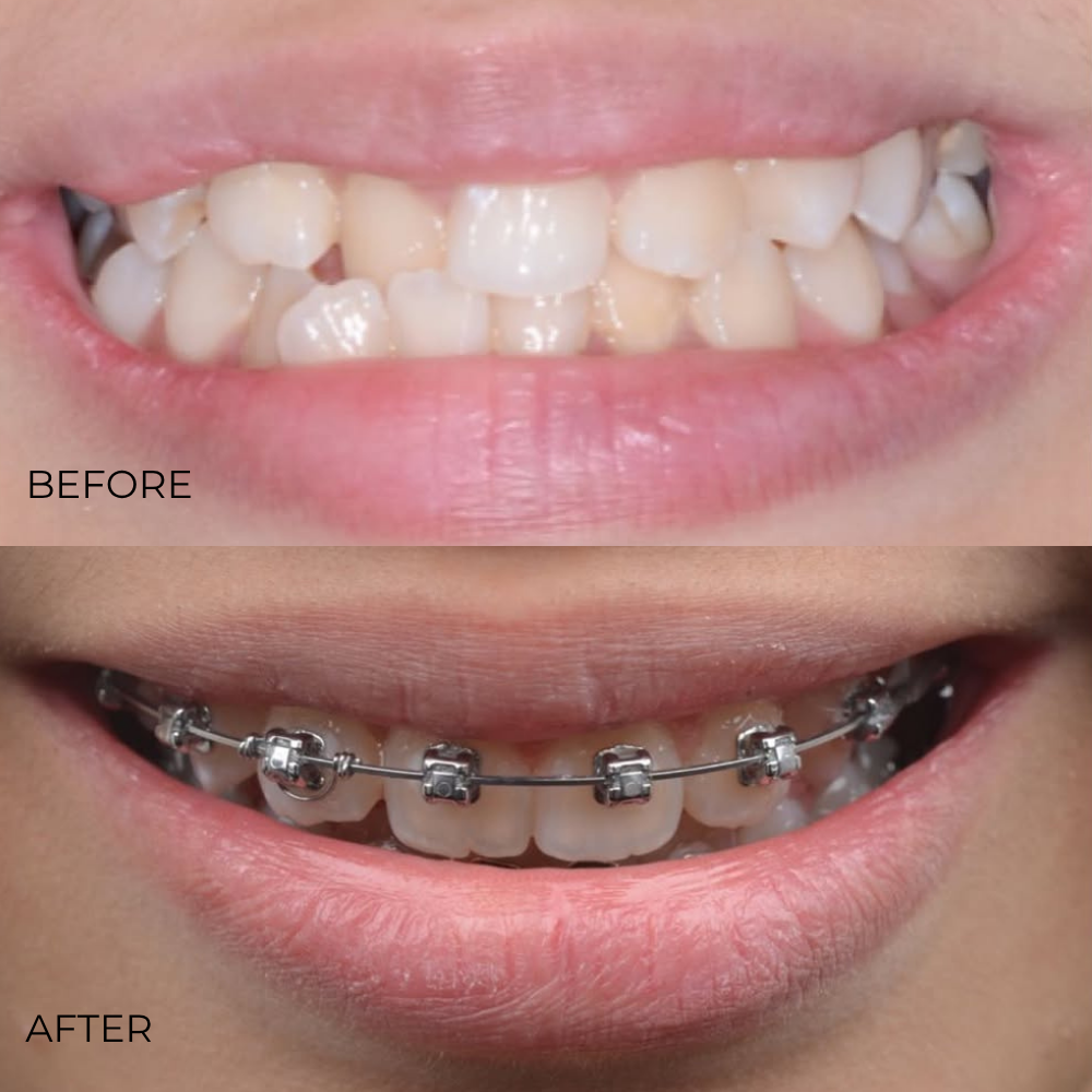 Before after webiste