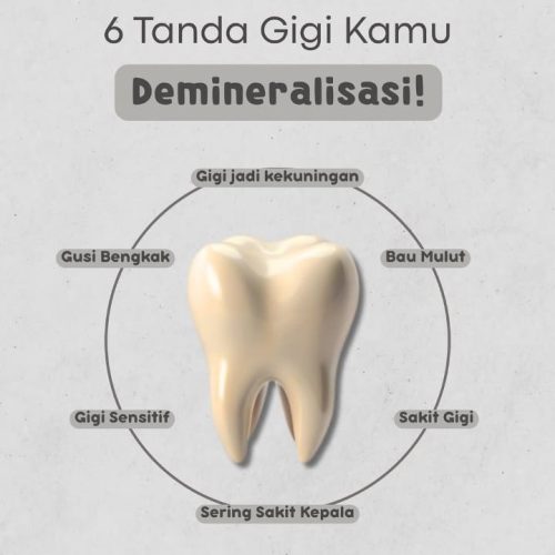 6 Tanda Gigi Kamu Demineralisasi!