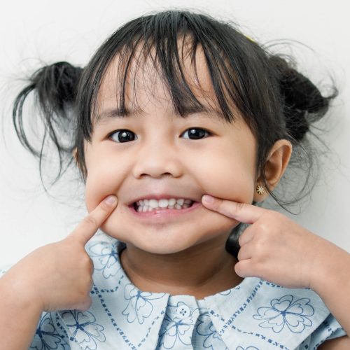 Cara Mencegah dan Mengatasi Gigi Karies Pada Anak